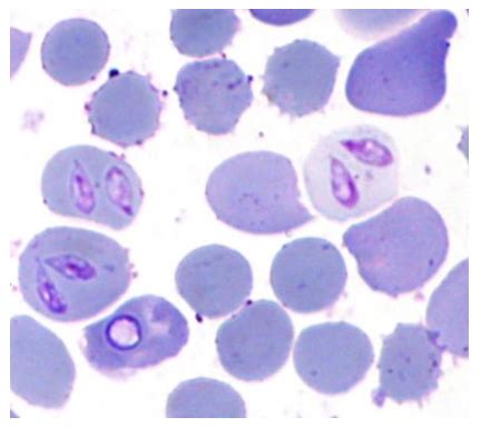  Babesia! A Tiny Blood Parasite with a Massive Impact on Mammalian Health